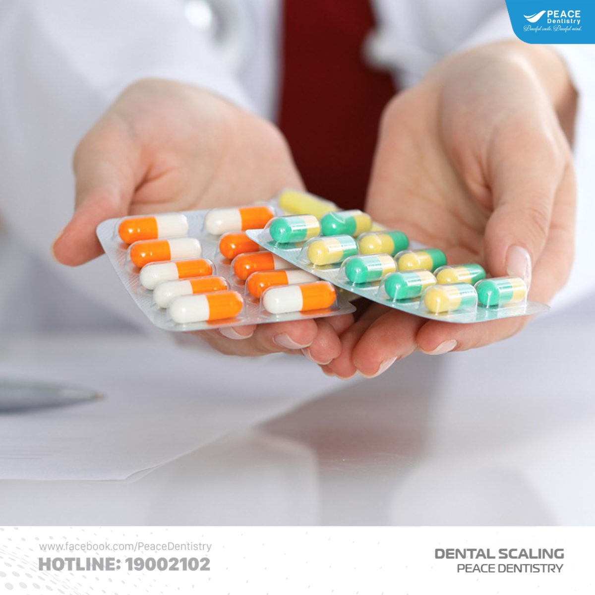 cạo vôi răng điều trị nha chu 2