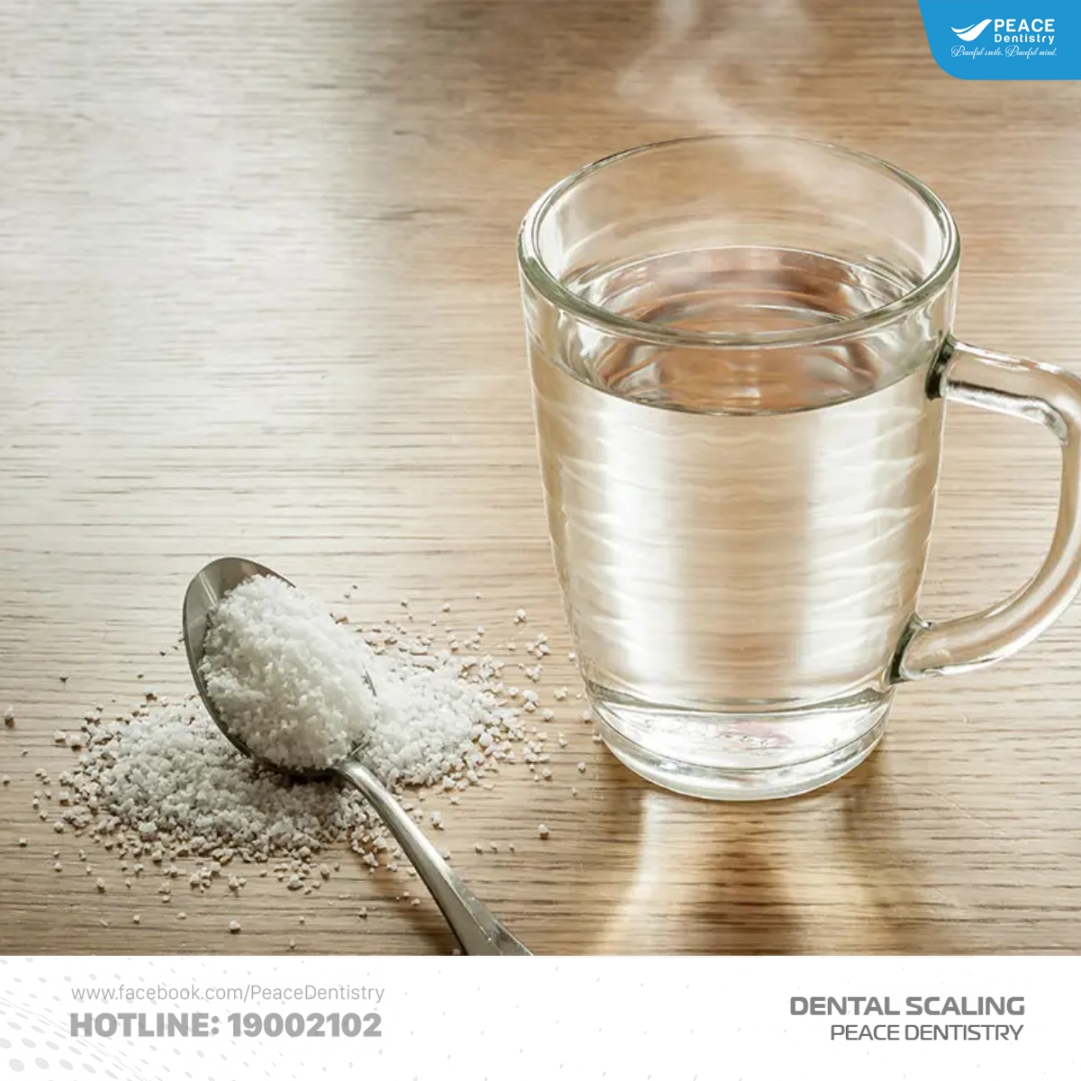 cạo vôi răng điều trị nha chu 5