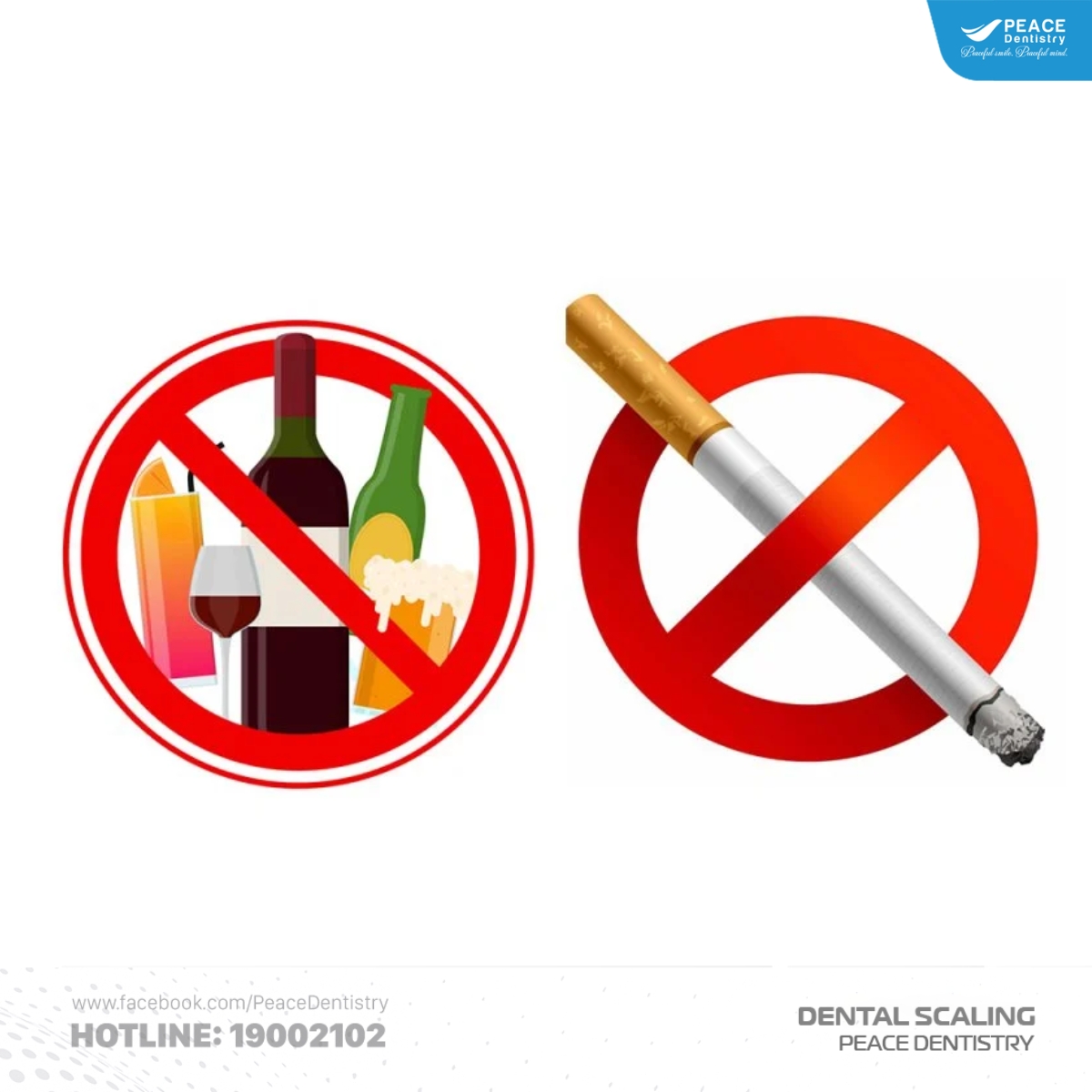 cạo vôi răng điều trị nha chu 7