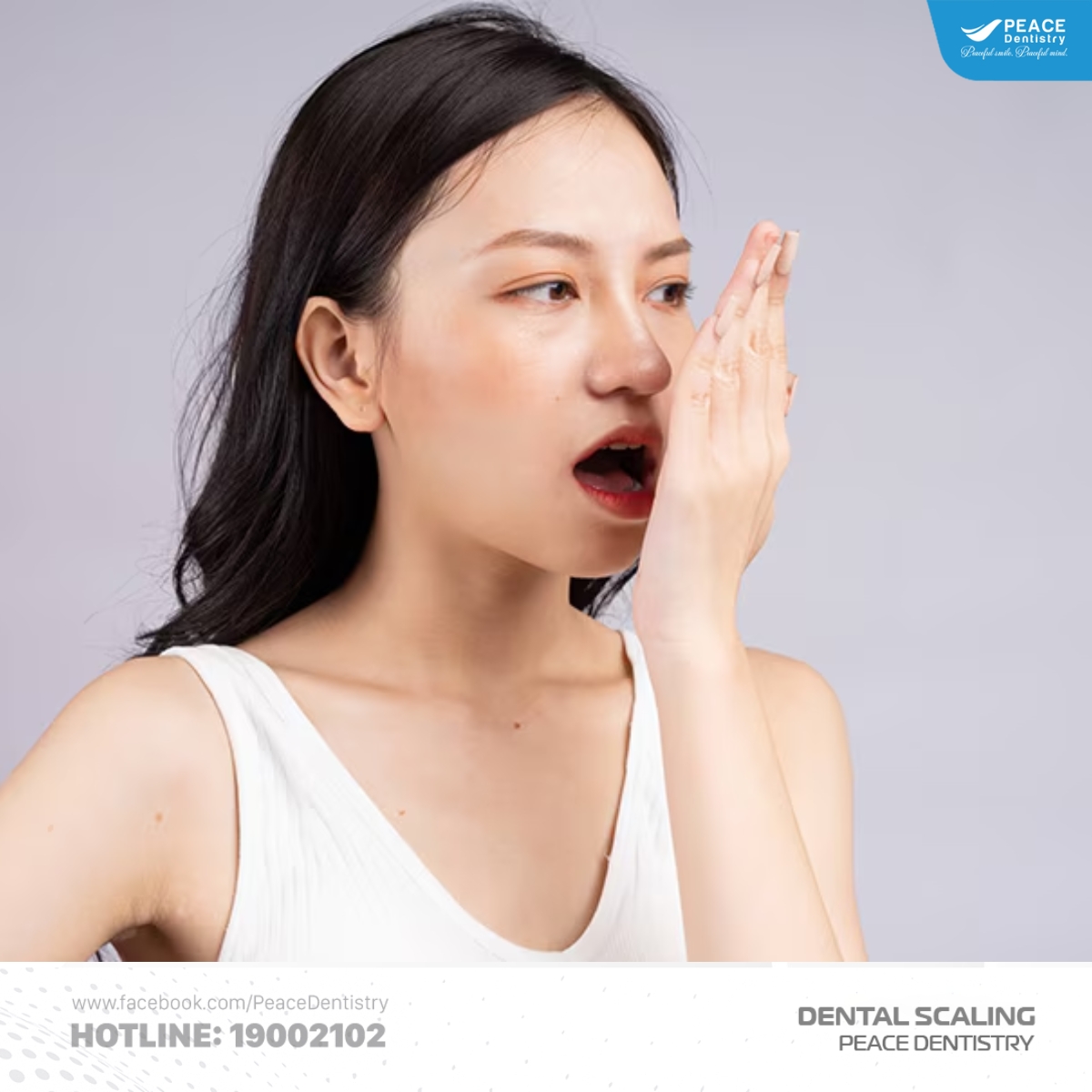 mức độ ảnh hưởng của cao răng độ 2