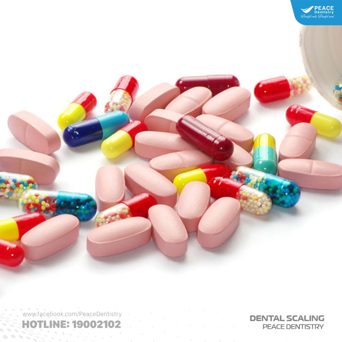 nguyên nhân cao răng có màu đen