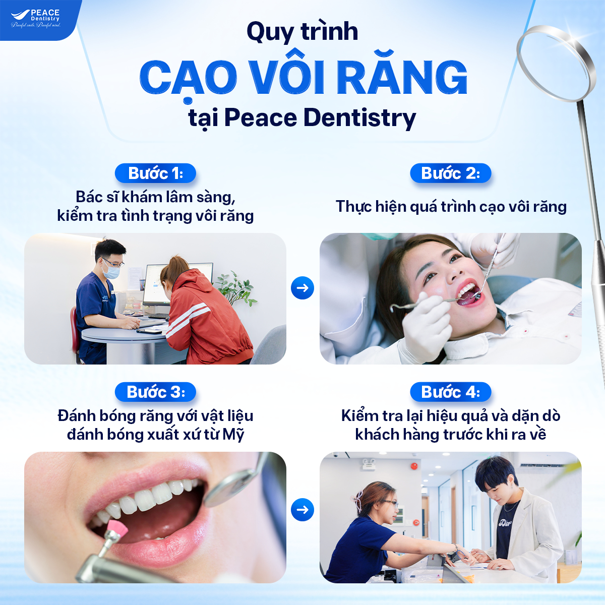 quy trình cạo vôi răng