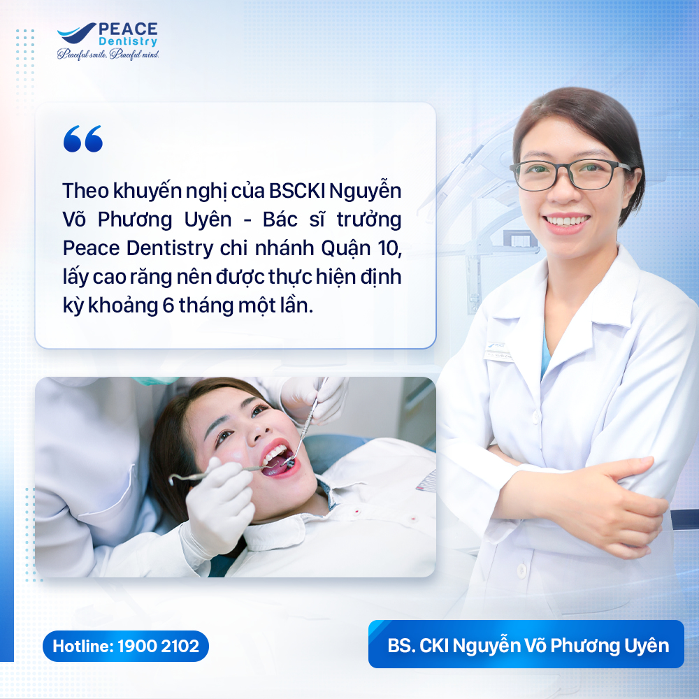 bác sĩ chia sẻ bao lâu lấy cao răng 1 lần