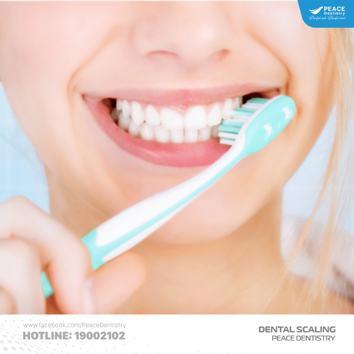 cách chăm sóc răng miệng sau khi lấy cao răng