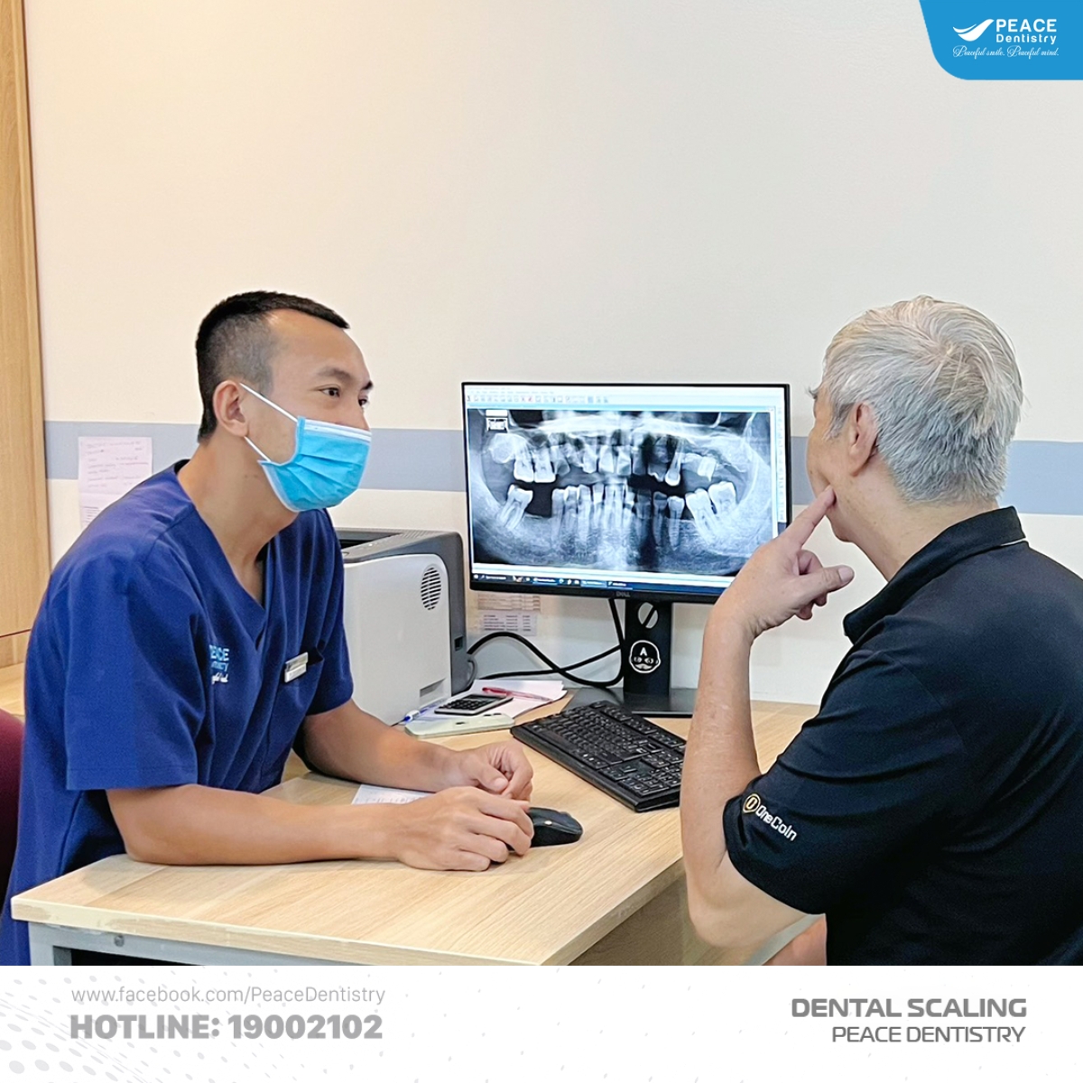 cách chăm sóc răng sứ