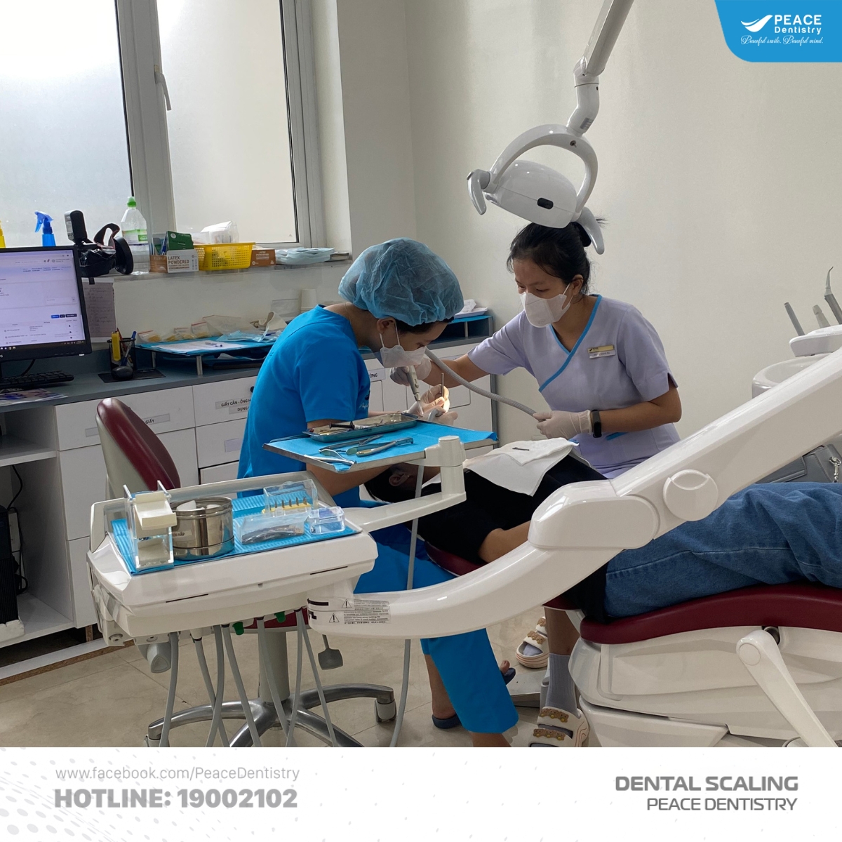 cách phòng ngừa răng bị vôi hóa