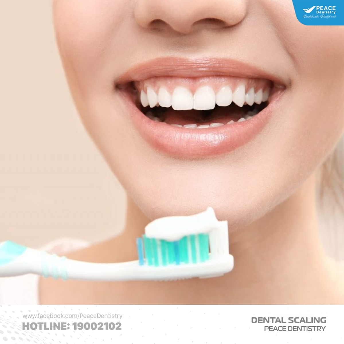 cách vệ sinh răng miệng sau khi cạo vôi răng độ 3