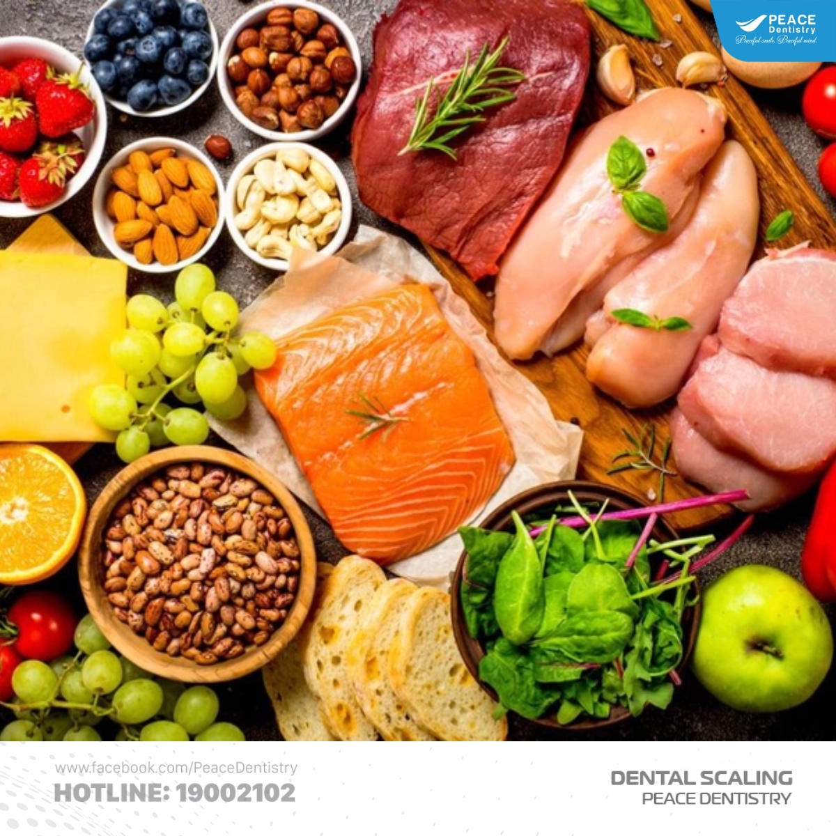 chế độ ăn uống phù hợp sau khi lấy cao răng