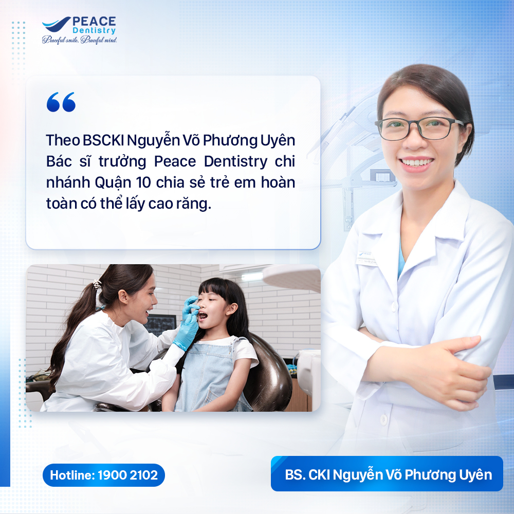 có nên lấy cao răng cho trẻ em không