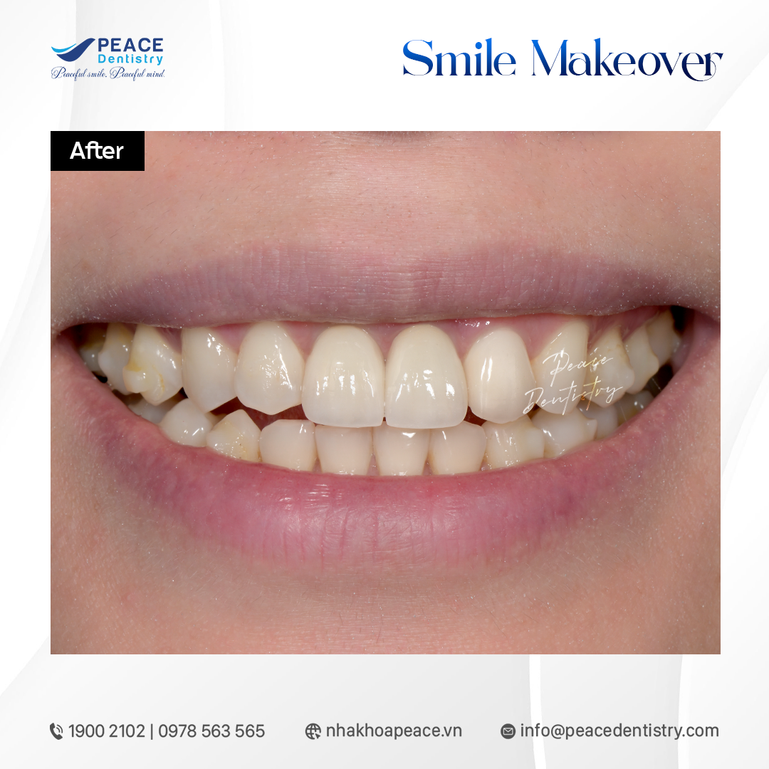 kết quả sự hòa hợp tuyệt đối