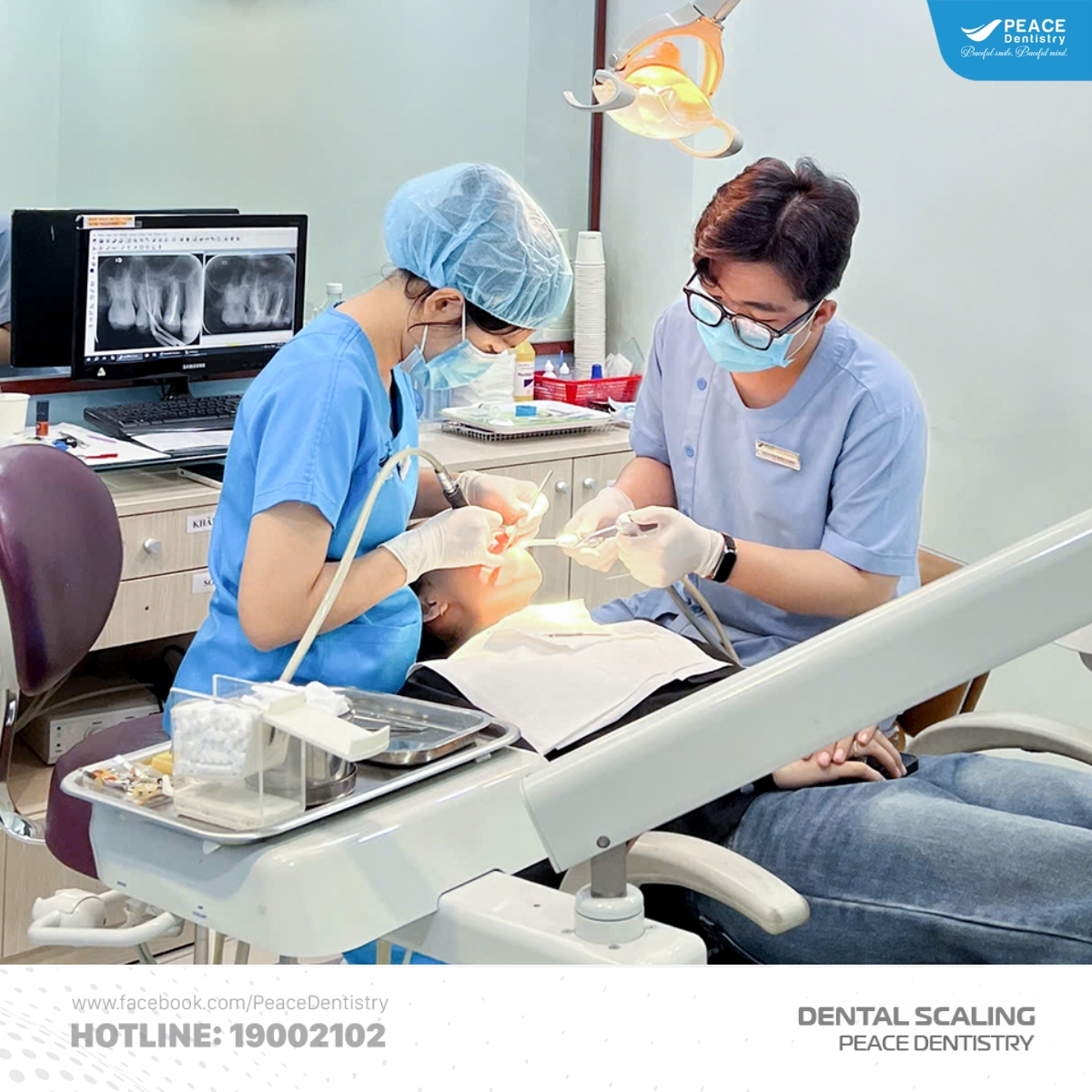 lấy cao răng có đau không tùy vào tâm lý khách hàng