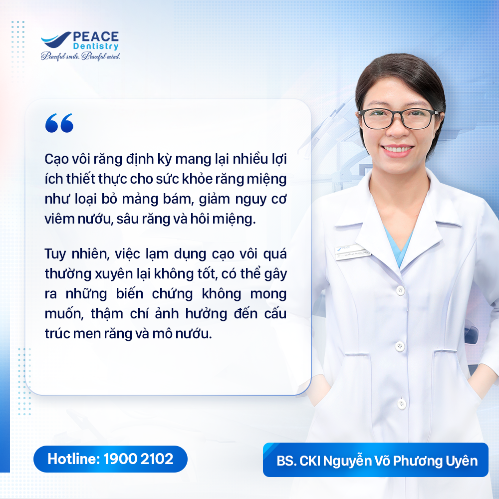 lấy cao răng nhiều có tốt không