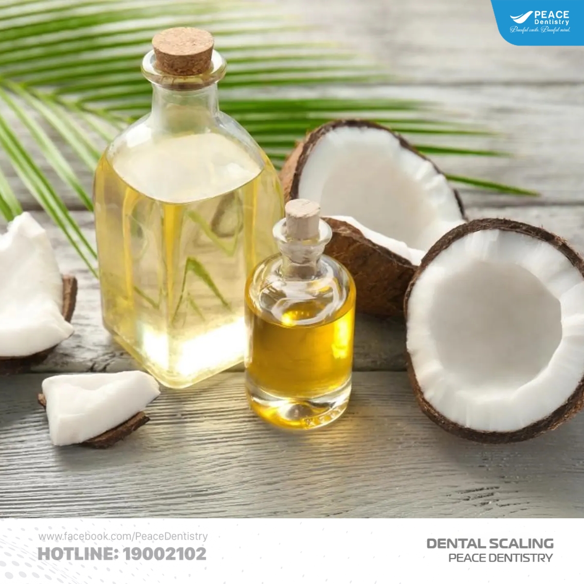 lấy cao răng tại nhà bằng dầu dừa