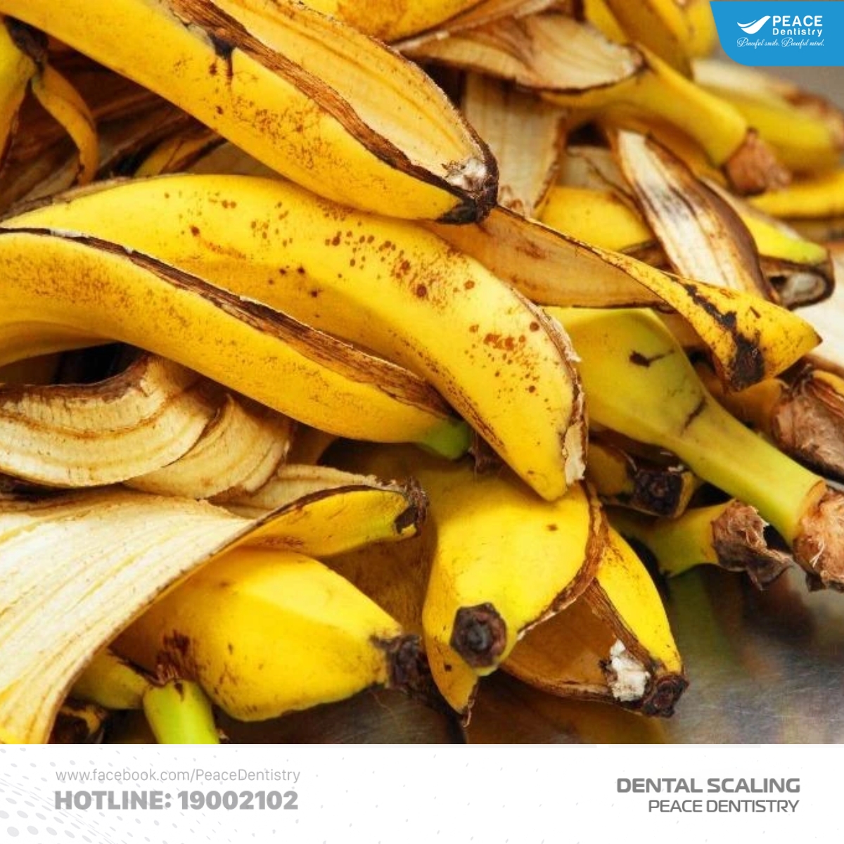 lấy cao răng tại nhà bằng vỏ chuối