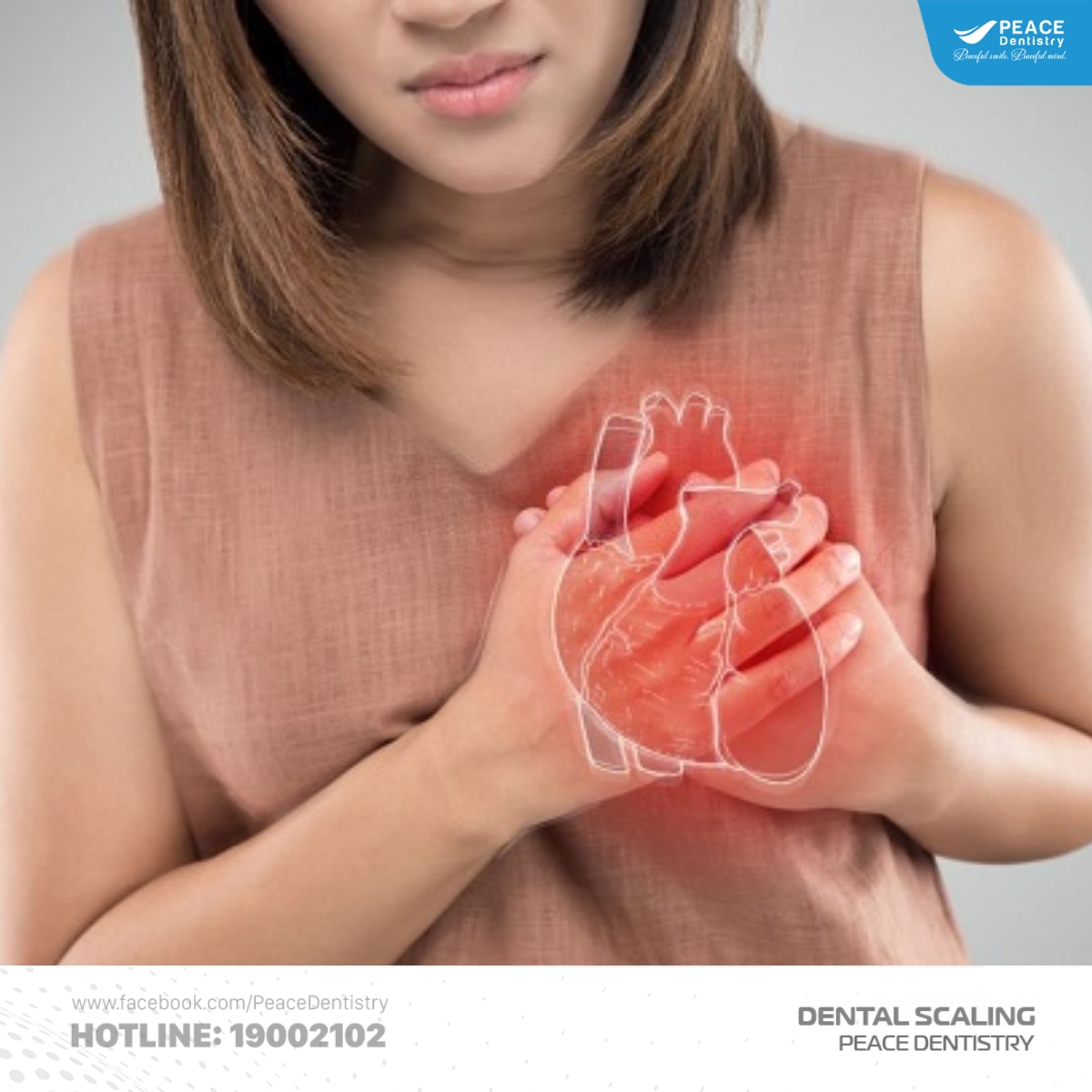 lấy vôi răng có tốt không