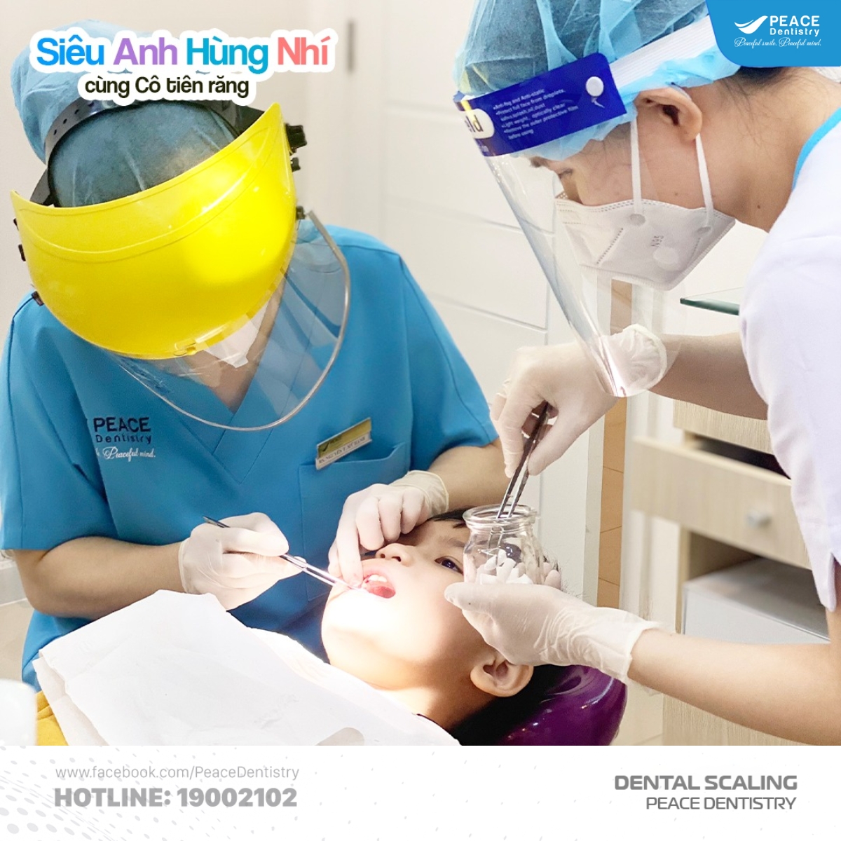 lưu ý khi lấy cao răng cho trẻ