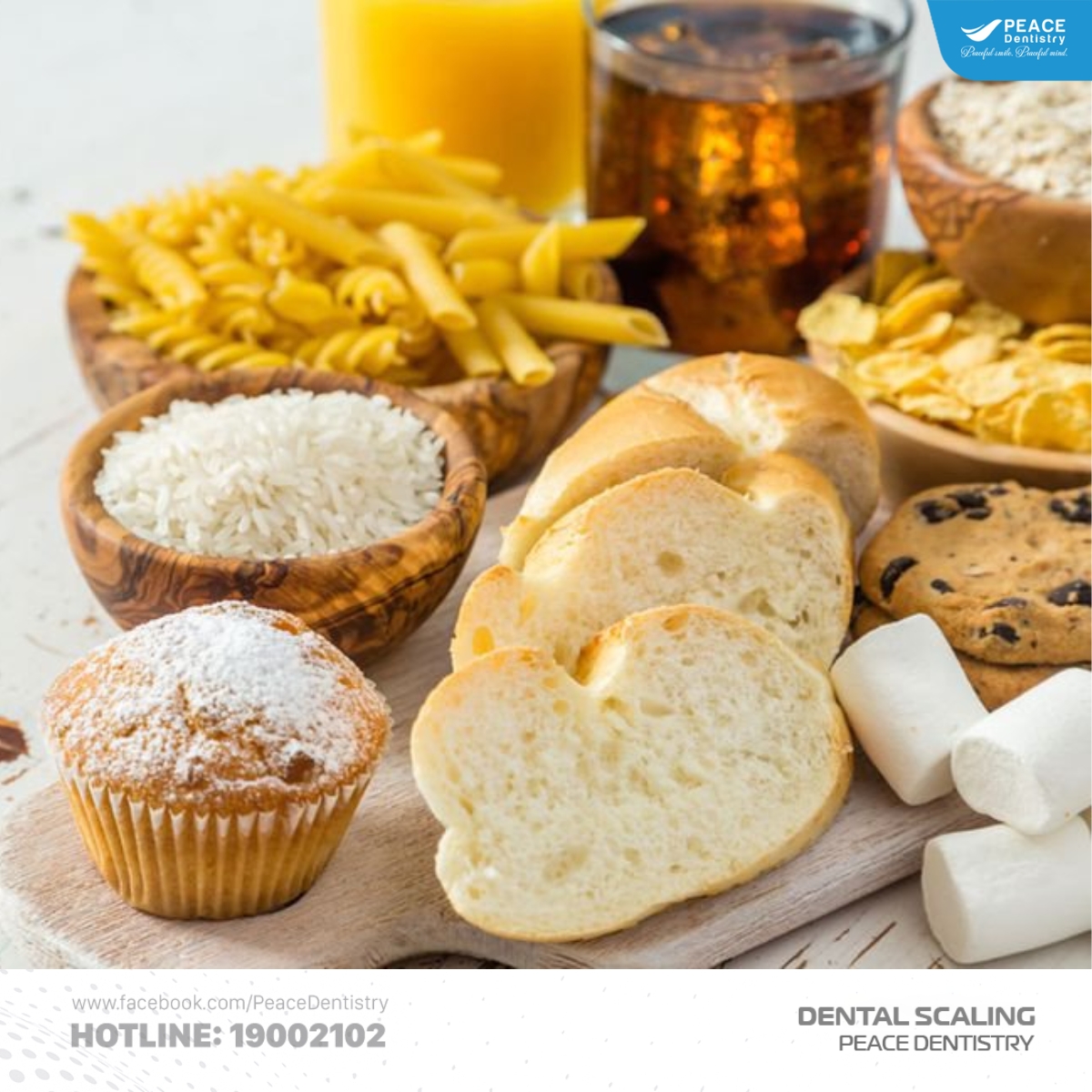 nguyên nhân vôi hóa chân răng