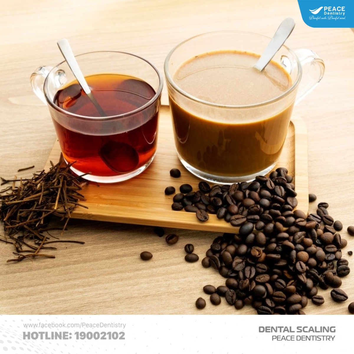 sau khi cạo vôi hạn chế thực phẩm dễ bám màu