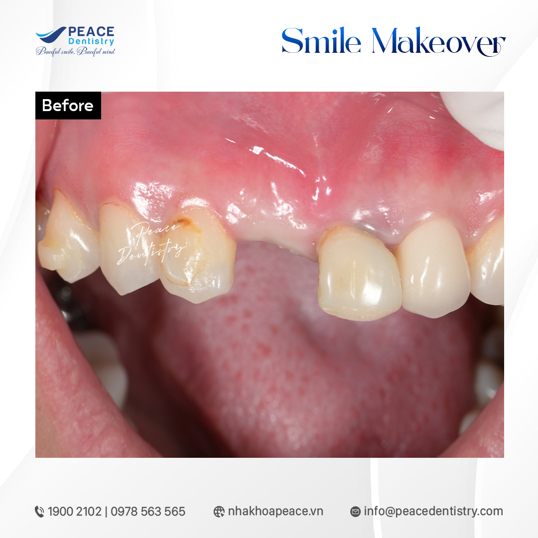 tình trạng thách thức trước khi điều trị