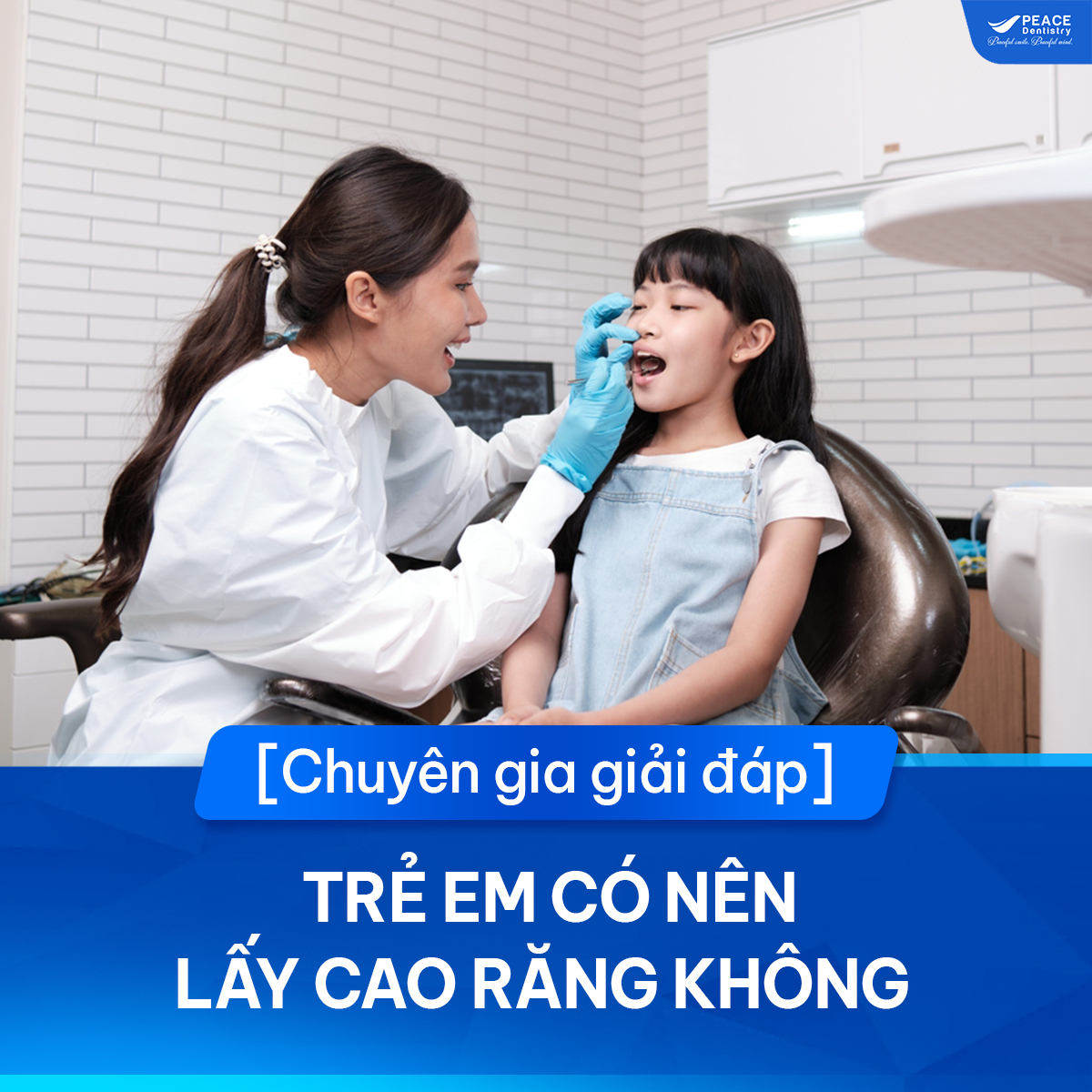 trẻ em có nên lây cao răng không