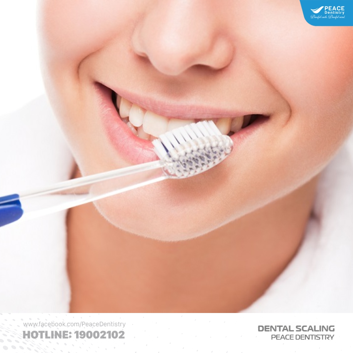 vì sao chảy máu khi cạo vôi răng