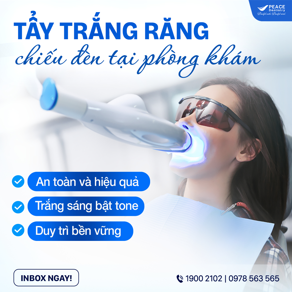 banner tẩy trắng răng
