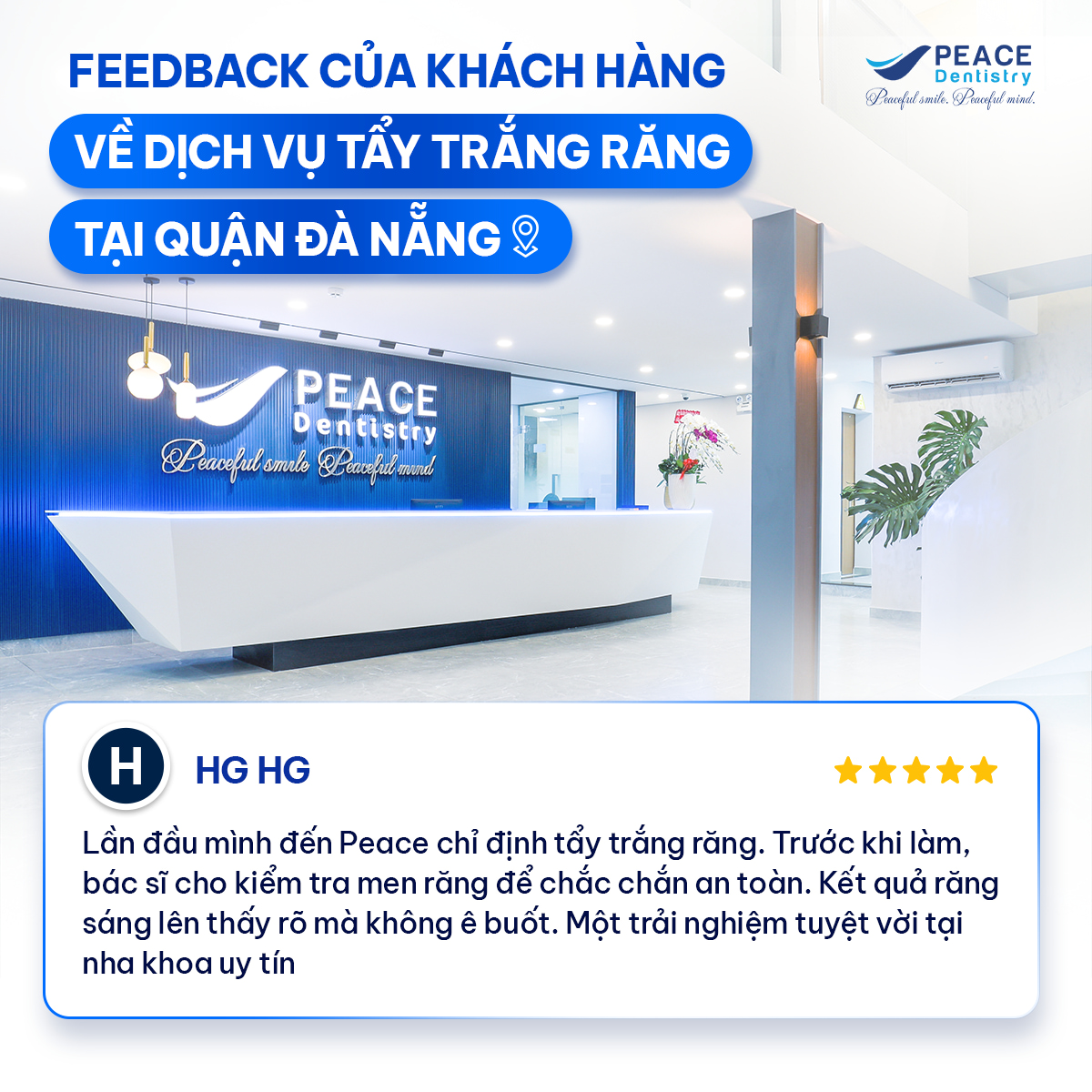 đánh giá tẩy trắng răng đà nẵng