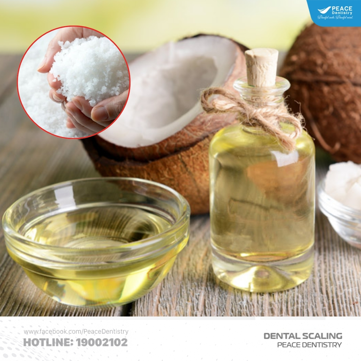 lấy cao răng tại nhà bằng muối và dầu dừa