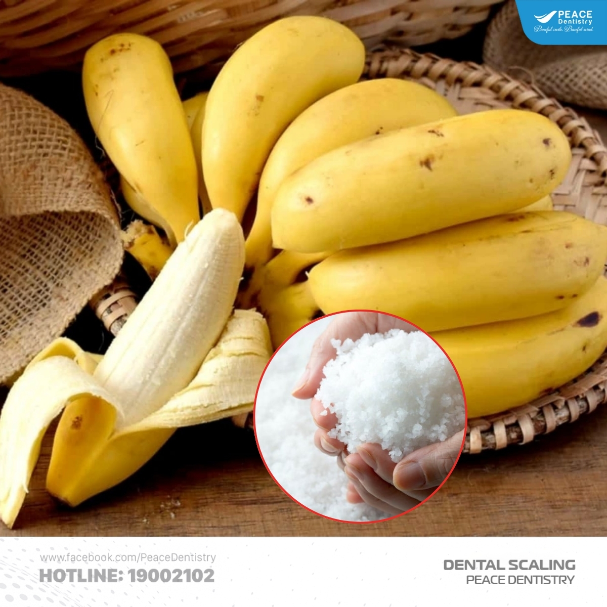 lấy cao răng tại nhà bằng muối và vỏ chuối