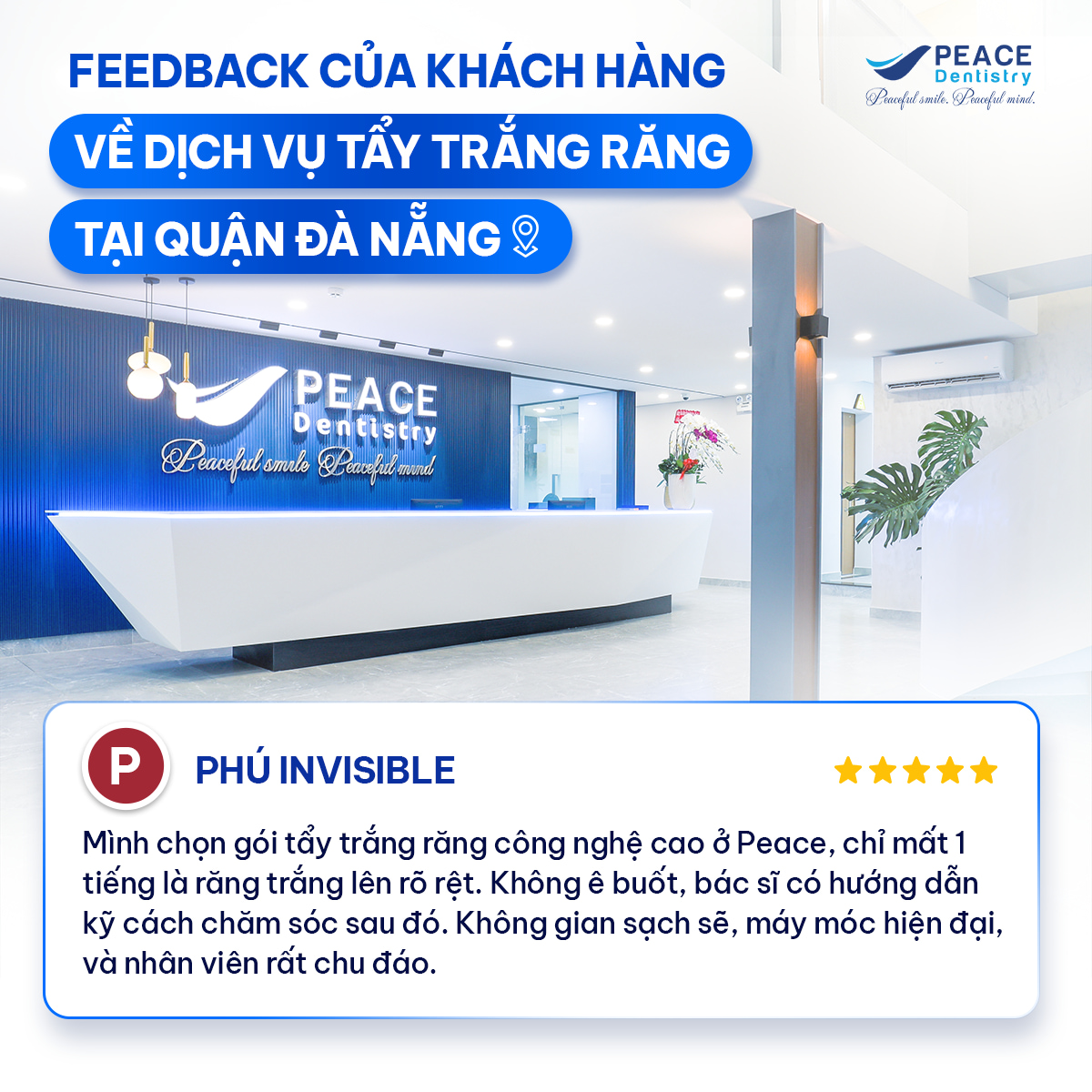 review của khách hàng tẩy trắng răng