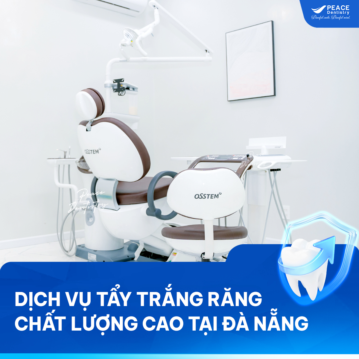 tẩy trắng răng tại đà nẵng