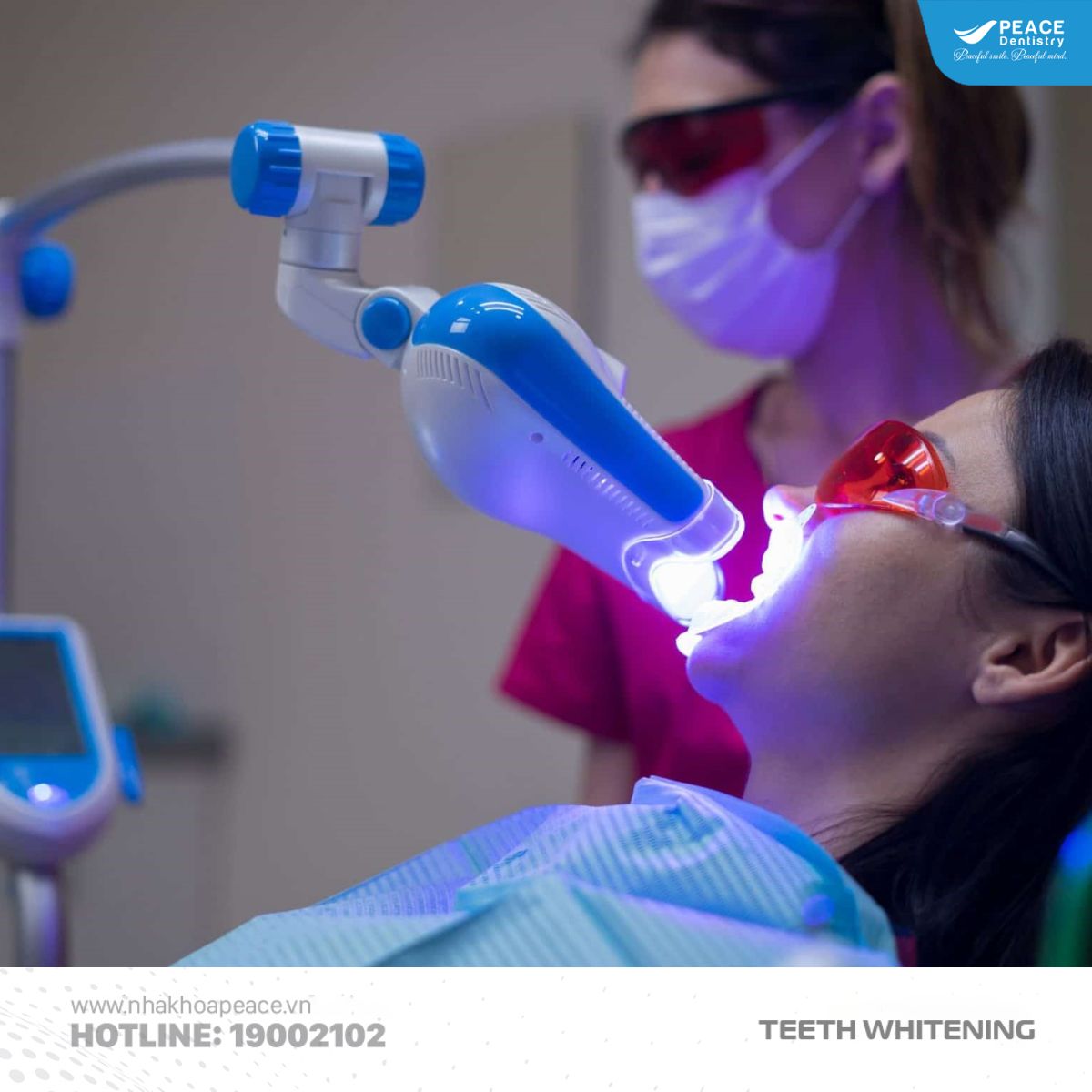 công nghệ tẩy trắng răng bằng ánh sáng xanh