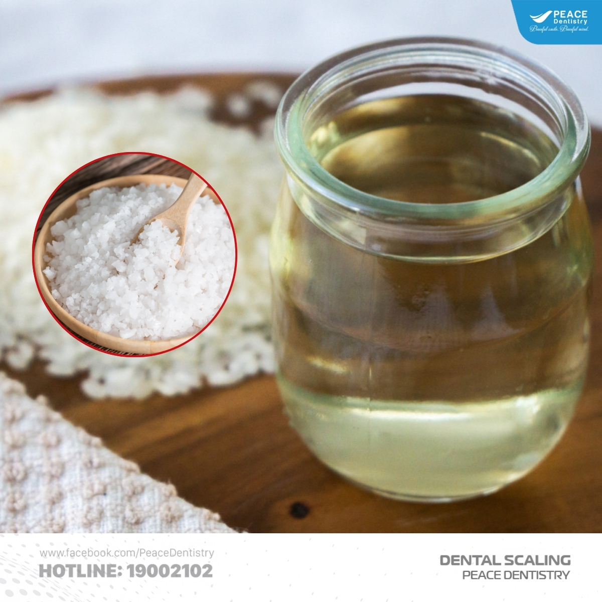 lấy cao răng tại nhà bằng giấm và muối