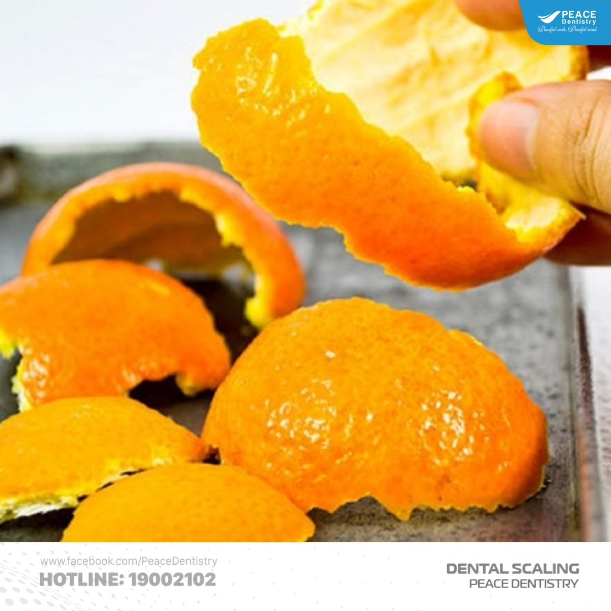 lấy cao răng tại nhà bằng giấm và vỏ cam