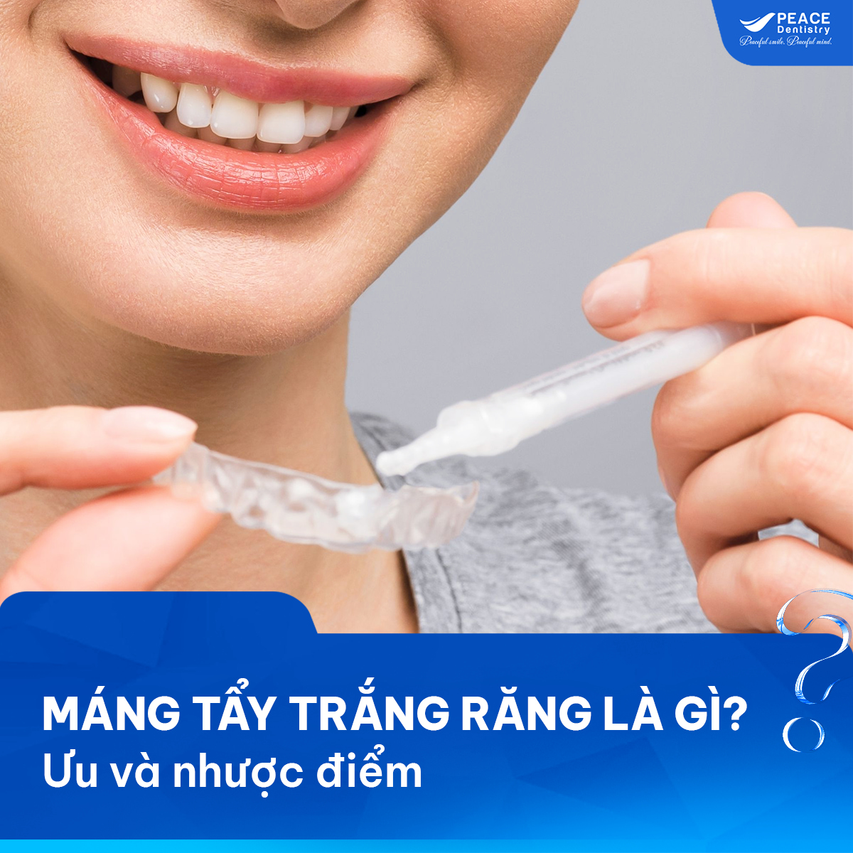máng tẩy trắng răng