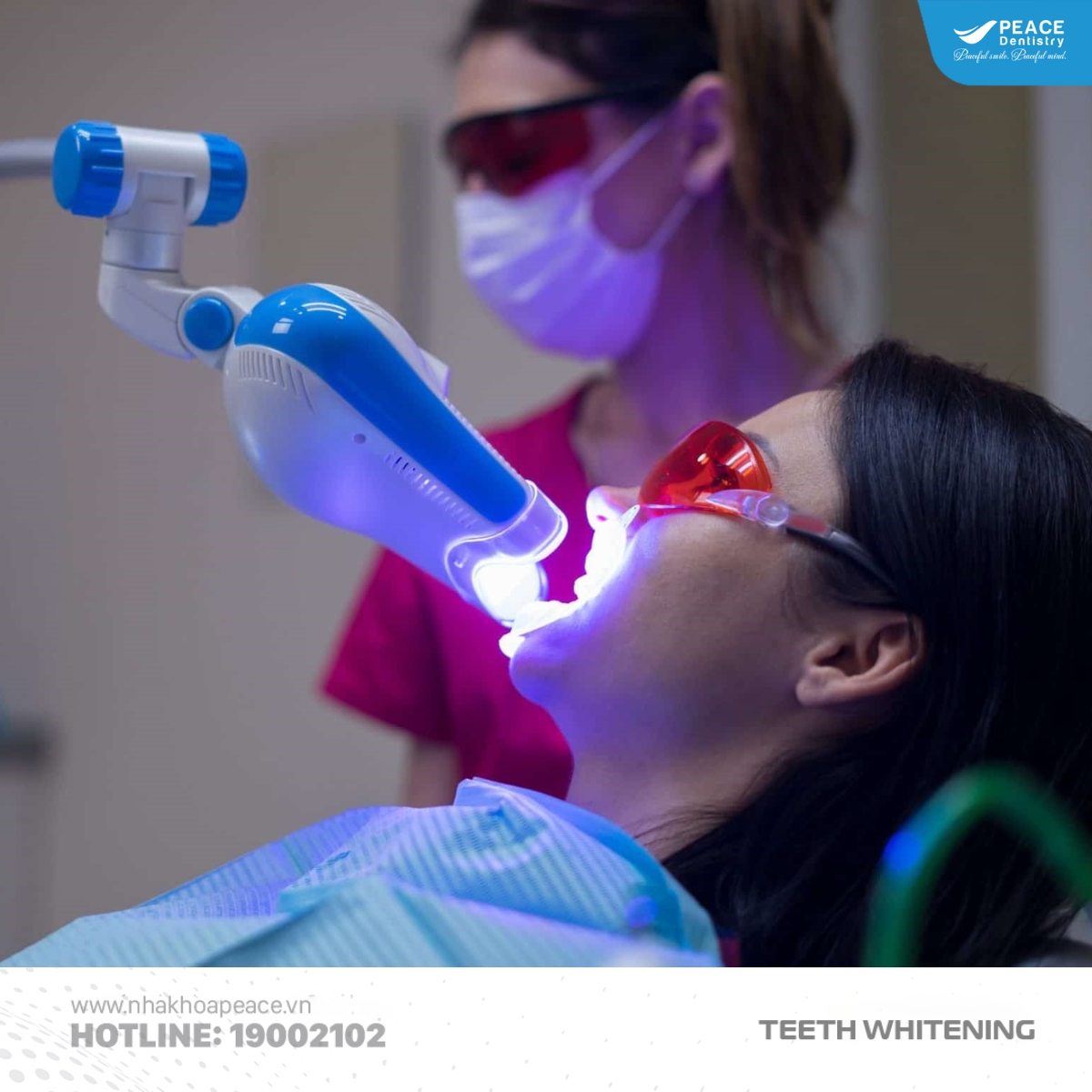 tẩy trắng răng giá rẻ có hiệu quả không