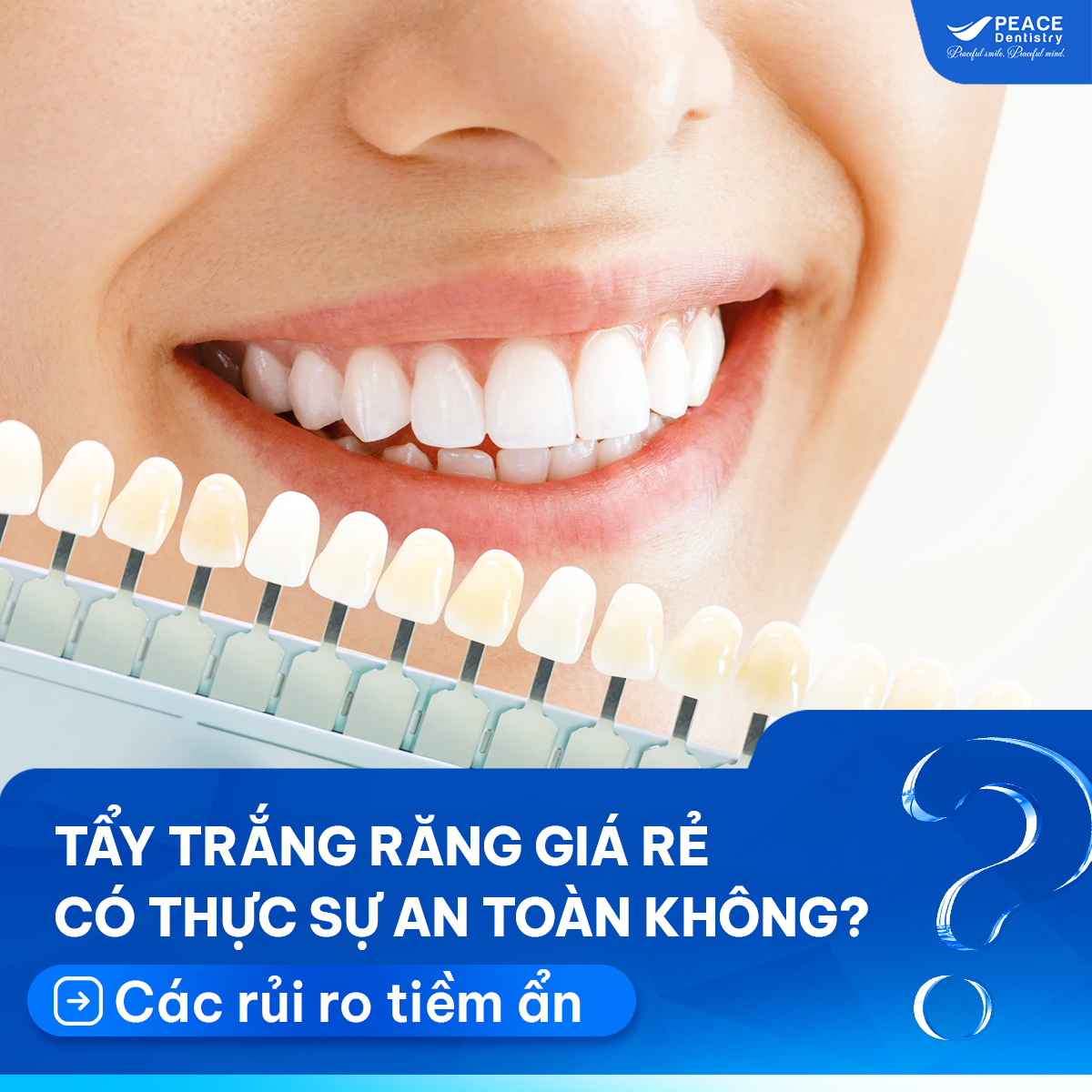 tẩy trắng răng giá rẻ