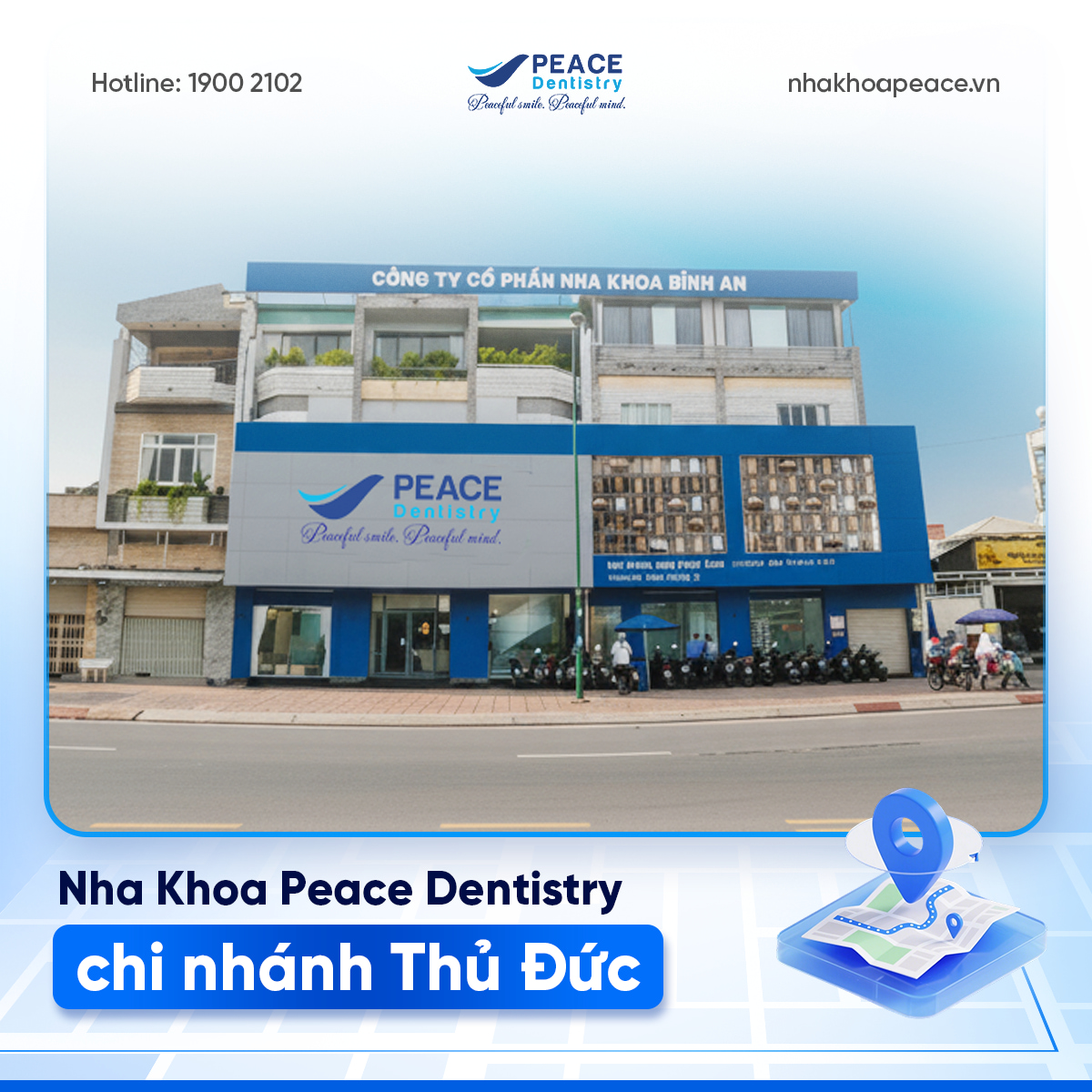 tẩy trắng răng tại peace dentistry thủ đức