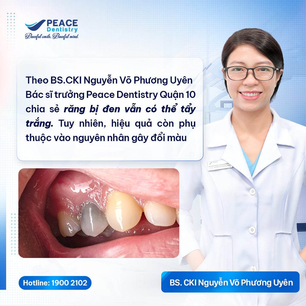 bác sĩ chia sẻ răng đen có tẩy trắng được không