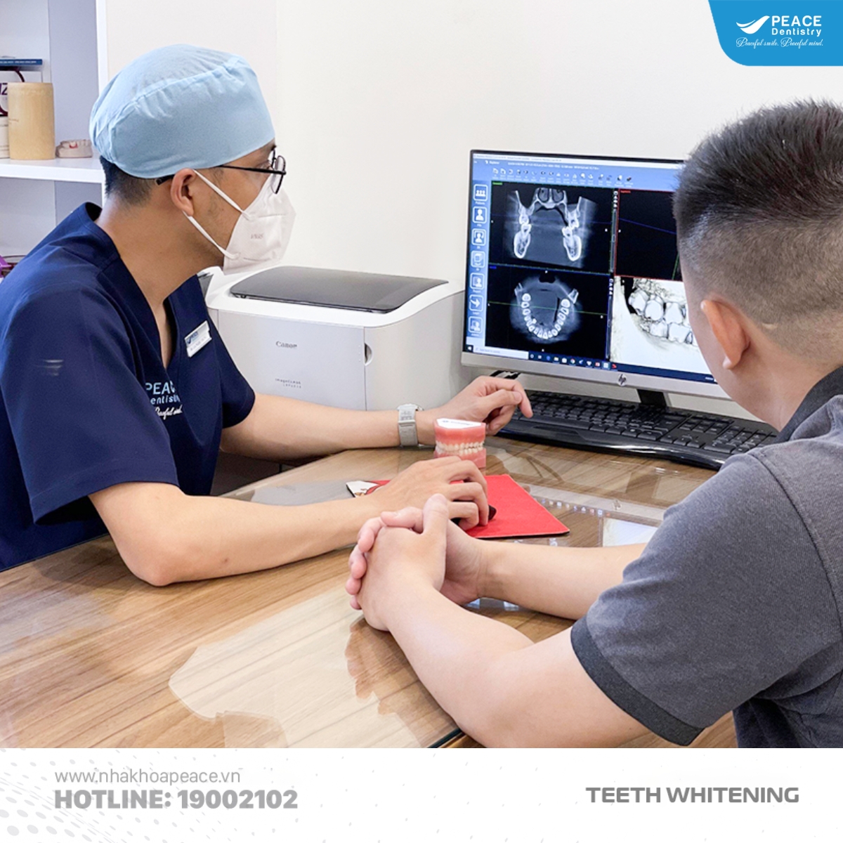 cách hạn chế răng ố vàng