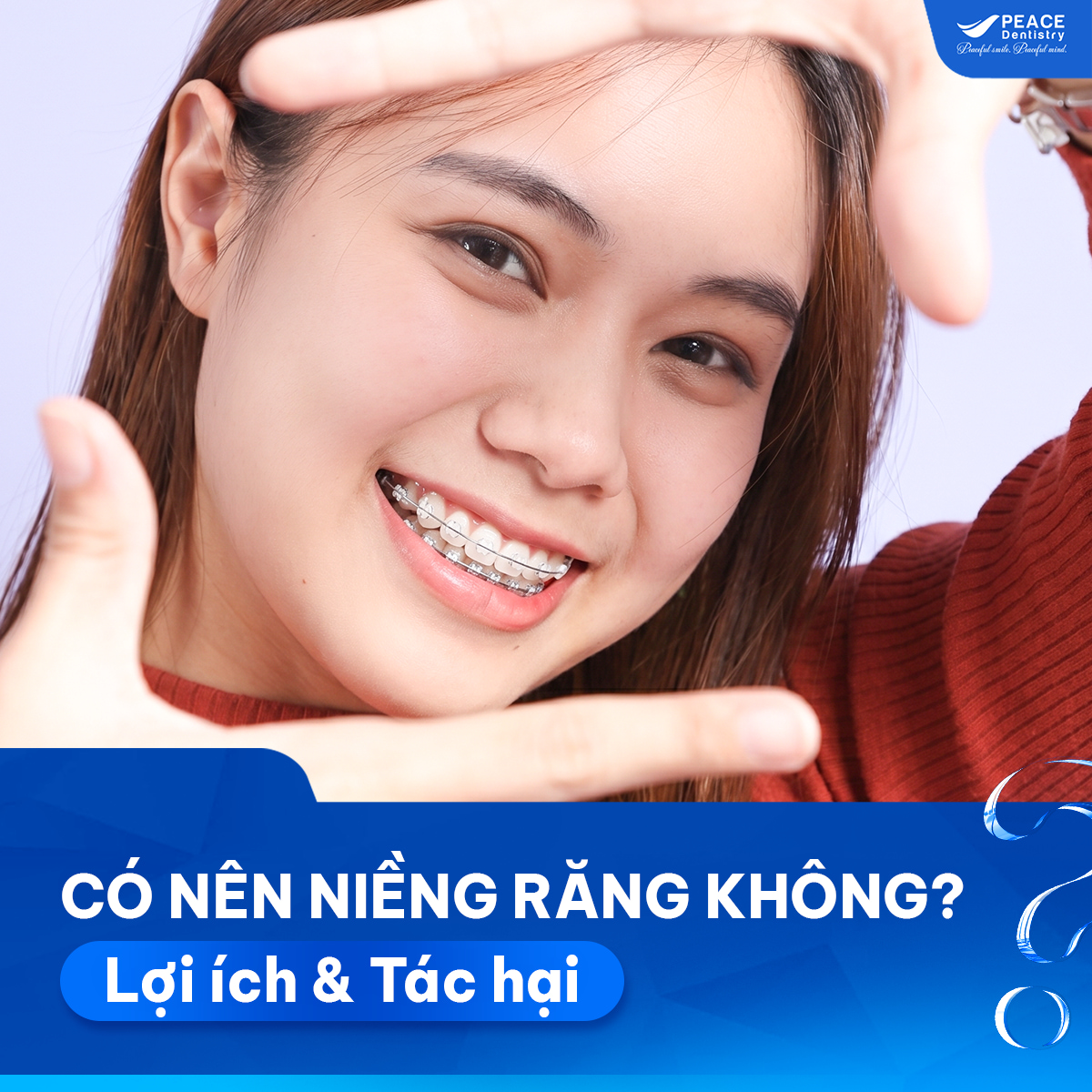 có nên niềng răng không