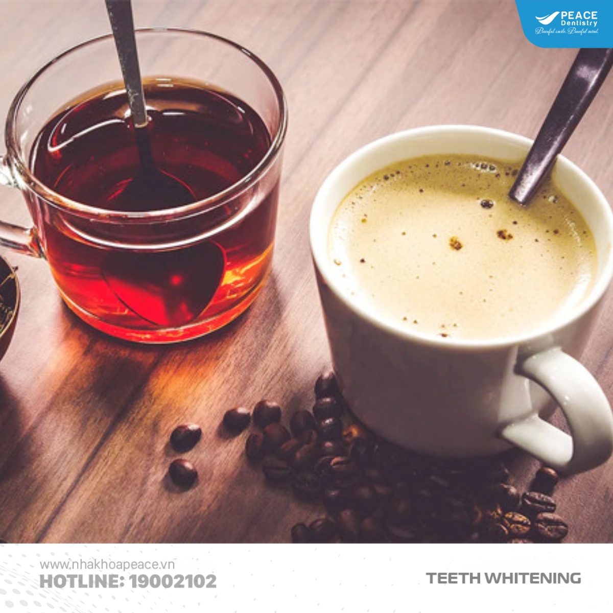 nguyên nhân răng bị ố vàng