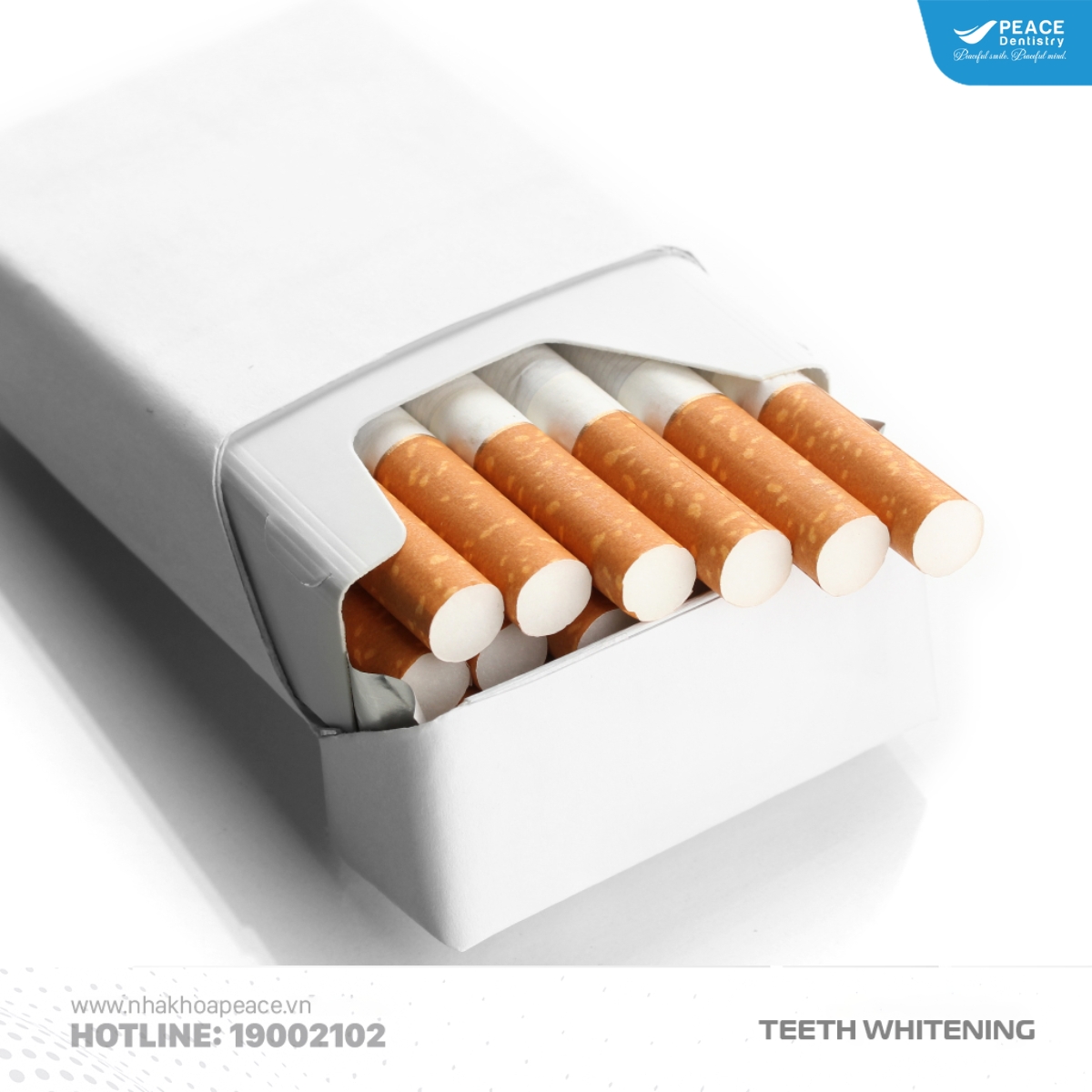 răng bị ố vàng do hút thuốc