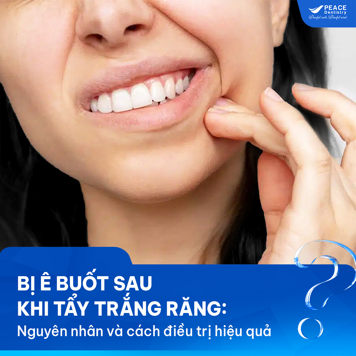 tẩy trắng răng bị ê buốt