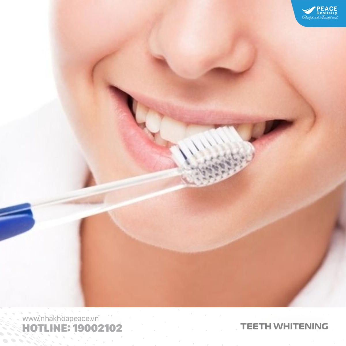 vệ sinh răng miệng đúng cách