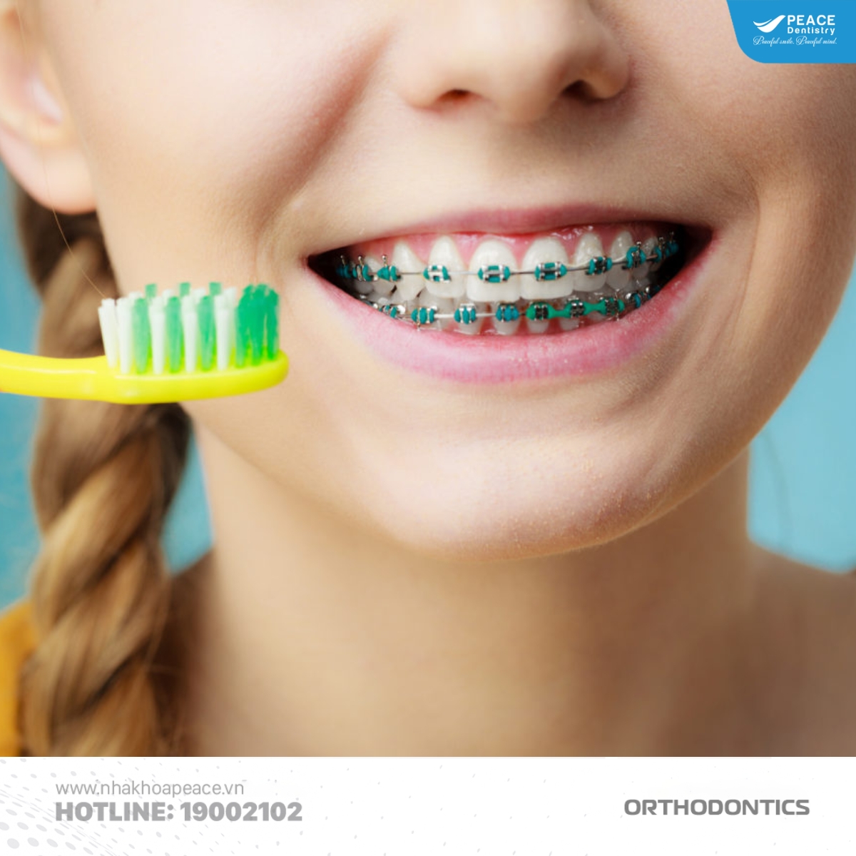 vệ sinh răng miệng khi niềng răng