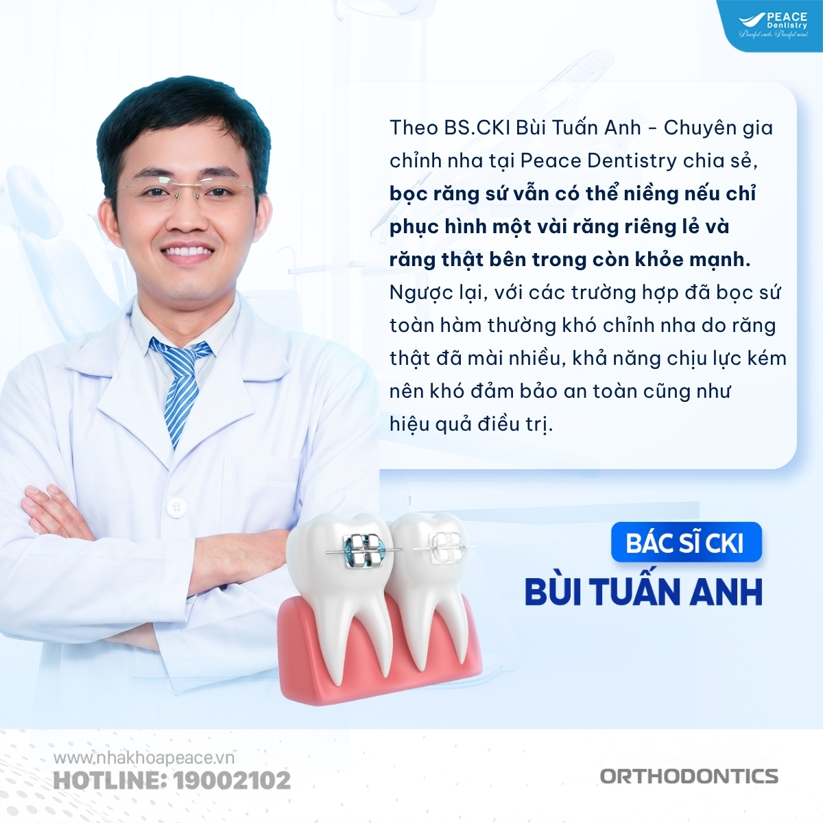 bác sĩ chia sẻ bọc răng sứ có niềng được không