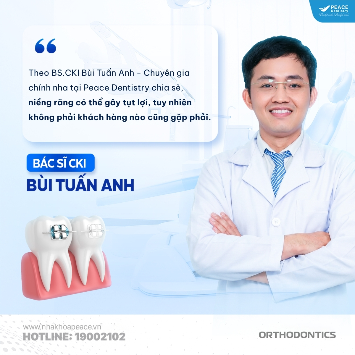 bác sĩ chia sẻ tụt lợi khi niềng răng