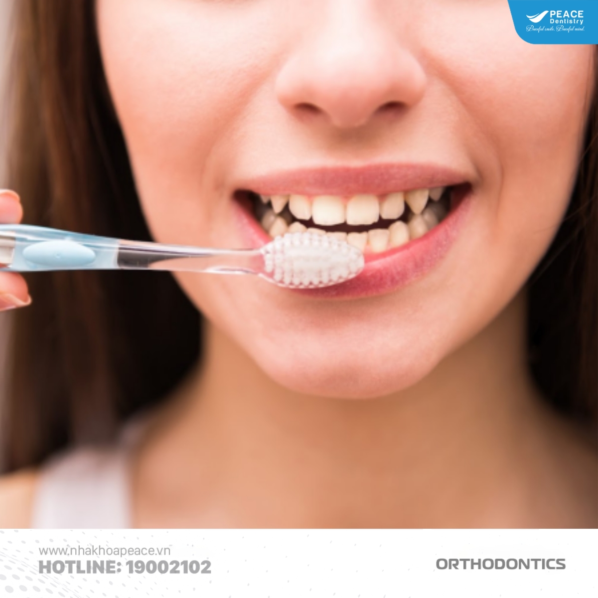 bí quyết ăn uống khi niềng răng