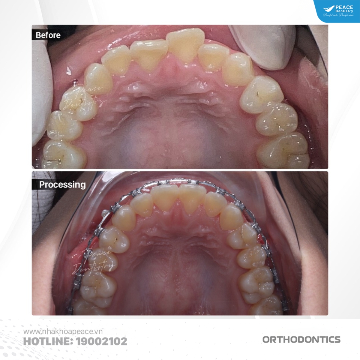 hình ảnh trước khi điều trị